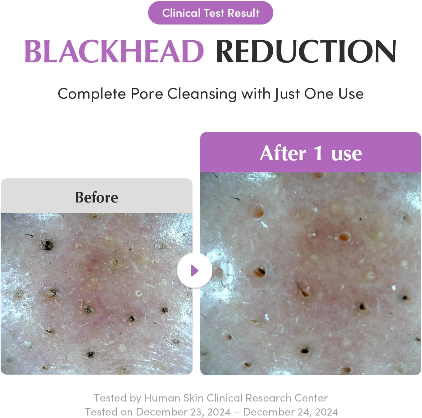 EQQUALBERRY Purple Rice Pore Purifying Pack Cleanser 130g
